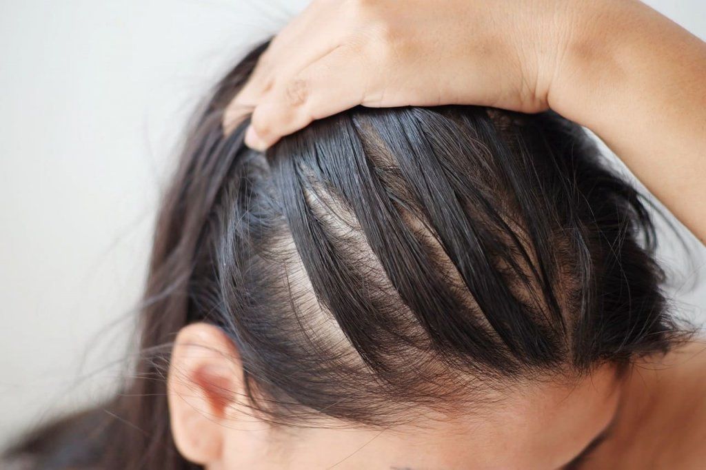 Выпадение волос у мужчин: причины и методы лечения